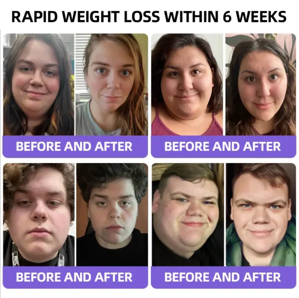 [See results in 7 days]Piguiay® GABA+GLP-1 Slimming Oral Strips🔥(Dissolves in 5 seconds, quick effect, long-lasting, effective against diabetes, insomnia, obesity and cardiovascular disease)🔥