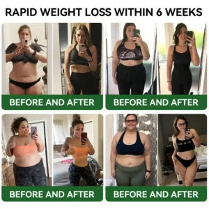𝑷𝒊𝒈𝒖𝒊𝒂𝒚® 𝑮𝑳𝑷-1 𝑺𝒍𝒊𝒎𝒎𝒊𝒏𝒈 & 𝑯𝒆𝒂𝒍𝒕𝒉 𝑩𝒐𝒐𝒔𝒕 𝑫𝒓𝒐𝒑𝒔 | 𝑭𝒐𝒐𝒅-𝒈𝒓𝒂𝒅𝒆 𝒇𝒂𝒕 𝒃𝒖𝒓𝒏𝒆𝒓 | 𝑫𝒆𝒗𝒆𝒍𝒐𝒑𝒆𝒅 𝒃𝒚 𝑶𝒃𝒆𝒔𝒊𝒕𝒚 𝑪𝒂𝒏𝒂𝒅𝒂🍀