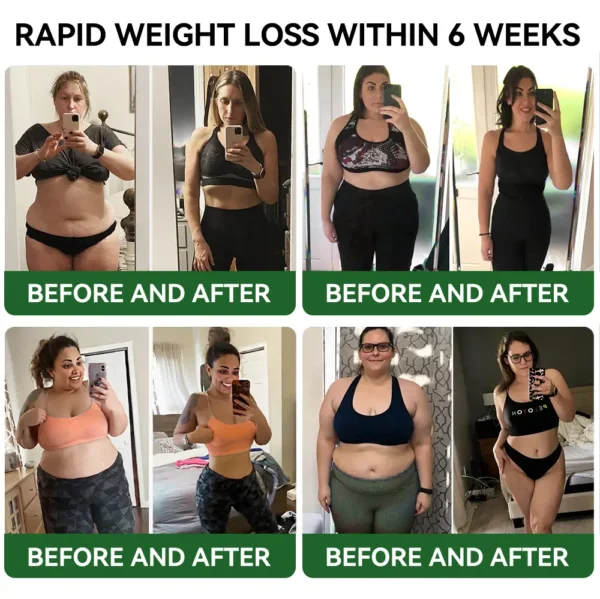 𝑷𝒊𝒈𝒖𝒊𝒂𝒚® 𝑮𝑳𝑷-1 𝑺𝒍𝒊𝒎𝒎𝒊𝒏𝒈 & 𝑯𝒆𝒂𝒍𝒕𝒉 𝑩𝒐𝒐𝒔𝒕 𝑫𝒓𝒐𝒑𝒔 | 𝑭𝒐𝒐𝒅-𝒈𝒓𝒂𝒅𝒆 𝒇𝒂𝒕 𝒃𝒖𝒓𝒏𝒆𝒓 | 𝑫𝒆𝒗𝒆𝒍𝒐𝒑𝒆𝒅 𝒃𝒚 𝑶𝒃𝒆𝒔𝒊𝒕𝒚 𝑪𝒂𝒏𝒂𝒅𝒂🍀