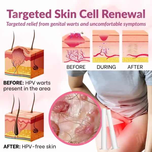 Piguiay® Femina HPV Relief Gel✨𝐄𝐟𝐟𝐞𝐜𝐭𝐢𝐯𝐞 𝐑𝐞𝐥𝐢𝐞𝐟 𝐟𝐫𝐨𝐦 𝐇𝐏𝐕 𝐒𝐲𝐦𝐩𝐭𝐨𝐦𝐬✨