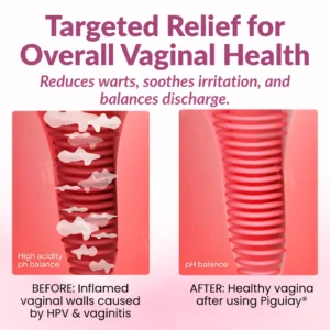 Piguiay® Femina HPV Relief Gel✨𝐄𝐟𝐟𝐞𝐜𝐭𝐢𝐯𝐞 𝐑𝐞𝐥𝐢𝐞𝐟 𝐟𝐫𝐨𝐦 𝐇𝐏𝐕 𝐒𝐲𝐦𝐩𝐭𝐨𝐦𝐬✨