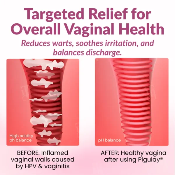 Piguiay® Femina HPV Relief Gel✨𝐄𝐟𝐟𝐞𝐜𝐭𝐢𝐯𝐞 𝐑𝐞𝐥𝐢𝐞𝐟 𝐟𝐫𝐨𝐦 𝐇𝐏𝐕 𝐒𝐲𝐦𝐩𝐭𝐨𝐦𝐬✨