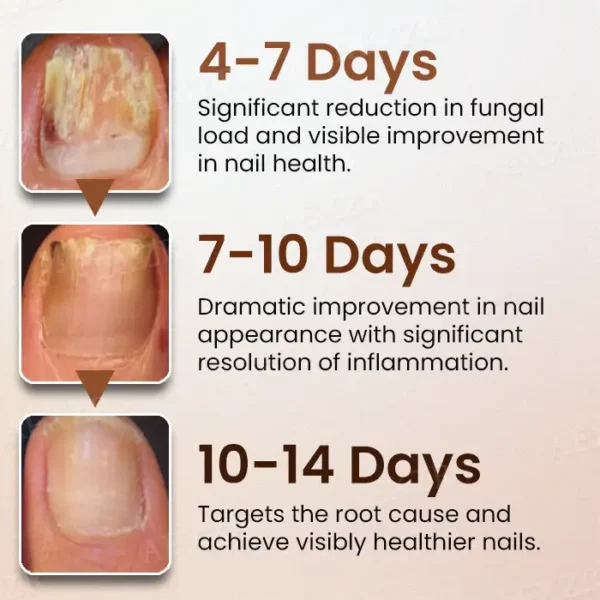 Piguiay® Nails Repairing Serum