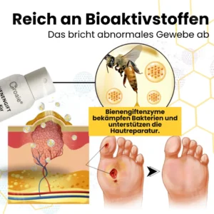 Croaie® Bienengift Spray für Diabetische Fußgeschwüre✔𝐬𝐢𝐜𝐡𝐭𝐛𝐚𝐫𝐞 𝐕𝐞𝐫𝐛𝐞𝐬𝐬𝐞𝐫𝐮𝐧𝐠 𝐢𝐧 𝟐-𝟑 𝐖𝐨𝐜𝐡𝐞𝐧✔