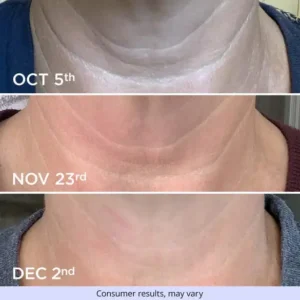 Newyuo® Tighten & Glow Moisturizer Lifts, Firms, and Restores Radiance