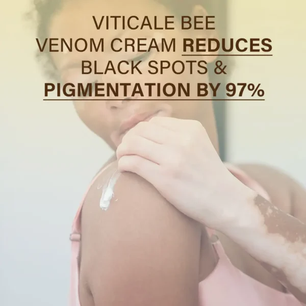 Oveallgo® VitiClear ULTRA Bee Venom Cream