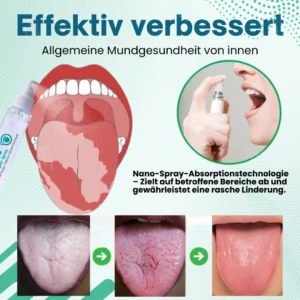 Piguiay® ProShield Zungenreinigungs-Spray✅ 𝐁𝐢𝐞𝐭𝐞𝐭 𝐋𝐢𝐧𝐝𝐞𝐫𝐮𝐧𝐠 𝐢𝐧 𝐧𝐮𝐫 𝟑 𝐌𝐢𝐧𝐮𝐭𝐞𝐧
