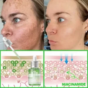𝐎𝐫𝐢𝐚𝐜𝐡® 𝐀𝟏𝟎+ 𝟔-𝐢𝐧-𝟏 𝐃𝐞𝐫𝐦𝐚𝐑𝐞𝐩𝐚𝐢𝐫 𝐒𝐞𝐫𝐮𝐦 𝐅𝐃𝐀 𝐂𝐞𝐫𝐭𝐢𝐟𝐢𝐞𝐝 – 𝐅𝐢𝐫𝐦𝐬 𝐥𝐨𝐨𝐬𝐞 𝐬𝐤𝐢𝐧, 𝐟𝐚𝐝𝐞𝐬 𝐛𝐫𝐮𝐢𝐬𝐢𝐧𝐠 𝐚𝐧𝐝 𝐬𝐞𝐧𝐢𝐥𝐞 𝐩𝐮𝐫𝐩𝐮𝐫𝐚, 𝐚𝐧𝐝 𝐢𝐦𝐩𝐫𝐨𝐯𝐞𝐬 𝐤𝐞𝐫𝐚𝐭𝐢𝐧 𝐛𝐮𝐢𝐥𝐝𝐮𝐩, 𝐬𝐞𝐛𝐨𝐫𝐫𝐡𝐞𝐢𝐜 𝐝𝐞𝐫𝐦𝐚𝐭𝐢𝐭𝐢𝐬, 𝐚𝐧𝐝 𝐟𝐨𝐥𝐥𝐢𝐜𝐮𝐥𝐚𝐫 𝐤𝐞𝐫𝐚𝐭𝐨𝐬𝐢𝐬.
