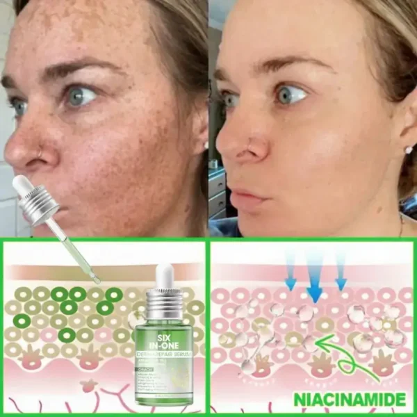 𝐎𝐫𝐢𝐚𝐜𝐡® 𝐀𝟏𝟎+ 𝟔-𝐢𝐧-𝟏 𝐃𝐞𝐫𝐦𝐚𝐑𝐞𝐩𝐚𝐢𝐫 𝐒𝐞𝐫𝐮𝐦 𝐅𝐃𝐀 𝐂𝐞𝐫𝐭𝐢𝐟𝐢𝐞𝐝 – 𝐅𝐢𝐫𝐦𝐬 𝐥𝐨𝐨𝐬𝐞 𝐬𝐤𝐢𝐧, 𝐟𝐚𝐝𝐞𝐬 𝐛𝐫𝐮𝐢𝐬𝐢𝐧𝐠 𝐚𝐧𝐝 𝐬𝐞𝐧𝐢𝐥𝐞 𝐩𝐮𝐫𝐩𝐮𝐫𝐚, 𝐚𝐧𝐝 𝐢𝐦𝐩𝐫𝐨𝐯𝐞𝐬 𝐤𝐞𝐫𝐚𝐭𝐢𝐧 𝐛𝐮𝐢𝐥𝐝𝐮𝐩, 𝐬𝐞𝐛𝐨𝐫𝐫𝐡𝐞𝐢𝐜 𝐝𝐞𝐫𝐦𝐚𝐭𝐢𝐭𝐢𝐬, 𝐚𝐧𝐝 𝐟𝐨𝐥𝐥𝐢𝐜𝐮𝐥𝐚𝐫 𝐤𝐞𝐫𝐚𝐭𝐨𝐬𝐢𝐬.