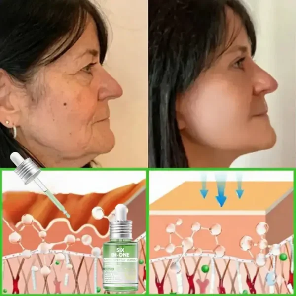 𝐎𝐫𝐢𝐚𝐜𝐡® 𝐀𝟏𝟎+ 𝟔-𝐢𝐧-𝟏 𝐃𝐞𝐫𝐦𝐚𝐑𝐞𝐩𝐚𝐢𝐫 𝐒𝐞𝐫𝐮𝐦 𝐅𝐃𝐀 𝐂𝐞𝐫𝐭𝐢𝐟𝐢𝐞𝐝 – 𝐅𝐢𝐫𝐦𝐬 𝐥𝐨𝐨𝐬𝐞 𝐬𝐤𝐢𝐧, 𝐟𝐚𝐝𝐞𝐬 𝐛𝐫𝐮𝐢𝐬𝐢𝐧𝐠 𝐚𝐧𝐝 𝐬𝐞𝐧𝐢𝐥𝐞 𝐩𝐮𝐫𝐩𝐮𝐫𝐚, 𝐚𝐧𝐝 𝐢𝐦𝐩𝐫𝐨𝐯𝐞𝐬 𝐤𝐞𝐫𝐚𝐭𝐢𝐧 𝐛𝐮𝐢𝐥𝐝𝐮𝐩, 𝐬𝐞𝐛𝐨𝐫𝐫𝐡𝐞𝐢𝐜 𝐝𝐞𝐫𝐦𝐚𝐭𝐢𝐭𝐢𝐬, 𝐚𝐧𝐝 𝐟𝐨𝐥𝐥𝐢𝐜𝐮𝐥𝐚𝐫 𝐤𝐞𝐫𝐚𝐭𝐨𝐬𝐢𝐬.