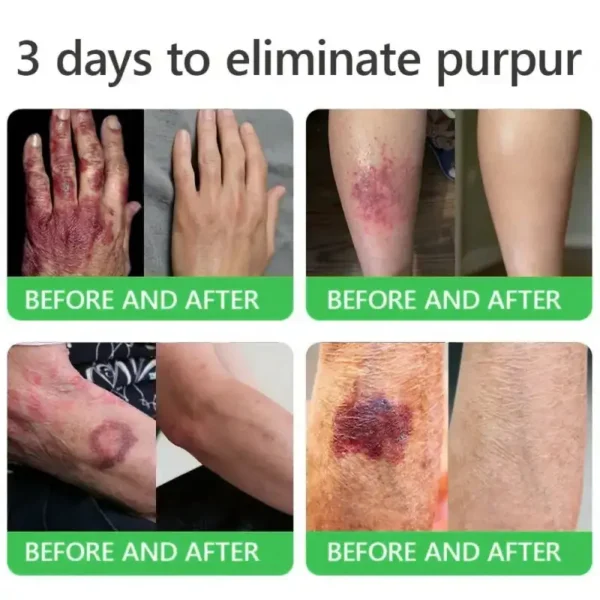 𝐎𝐫𝐢𝐚𝐜𝐡® 𝐀𝟏𝟎+ 𝟔-𝐢𝐧-𝟏 𝐃𝐞𝐫𝐦𝐚𝐑𝐞𝐩𝐚𝐢𝐫 𝐒𝐞𝐫𝐮𝐦 𝐅𝐃𝐀 𝐂𝐞𝐫𝐭𝐢𝐟𝐢𝐞𝐝 – 𝐅𝐢𝐫𝐦𝐬 𝐥𝐨𝐨𝐬𝐞 𝐬𝐤𝐢𝐧, 𝐟𝐚𝐝𝐞𝐬 𝐛𝐫𝐮𝐢𝐬𝐢𝐧𝐠 𝐚𝐧𝐝 𝐬𝐞𝐧𝐢𝐥𝐞 𝐩𝐮𝐫𝐩𝐮𝐫𝐚, 𝐚𝐧𝐝 𝐢𝐦𝐩𝐫𝐨𝐯𝐞𝐬 𝐤𝐞𝐫𝐚𝐭𝐢𝐧 𝐛𝐮𝐢𝐥𝐝𝐮𝐩, 𝐬𝐞𝐛𝐨𝐫𝐫𝐡𝐞𝐢𝐜 𝐝𝐞𝐫𝐦𝐚𝐭𝐢𝐭𝐢𝐬, 𝐚𝐧𝐝 𝐟𝐨𝐥𝐥𝐢𝐜𝐮𝐥𝐚𝐫 𝐤𝐞𝐫𝐚𝐭𝐨𝐬𝐢𝐬.