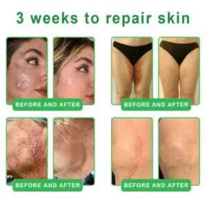 𝐎𝐫𝐢𝐚𝐜𝐡® 𝐀𝟏𝟎+ 𝟔-𝐢𝐧-𝟏 𝐃𝐞𝐫𝐦𝐚𝐑𝐞𝐩𝐚𝐢𝐫 𝐒𝐞𝐫𝐮𝐦 𝐅𝐃𝐀 𝐂𝐞𝐫𝐭𝐢𝐟𝐢𝐞𝐝 – 𝐅𝐢𝐫𝐦𝐬 𝐥𝐨𝐨𝐬𝐞 𝐬𝐤𝐢𝐧, 𝐟𝐚𝐝𝐞𝐬 𝐛𝐫𝐮𝐢𝐬𝐢𝐧𝐠 𝐚𝐧𝐝 𝐬𝐞𝐧𝐢𝐥𝐞 𝐩𝐮𝐫𝐩𝐮𝐫𝐚, 𝐚𝐧𝐝 𝐢𝐦𝐩𝐫𝐨𝐯𝐞𝐬 𝐤𝐞𝐫𝐚𝐭𝐢𝐧 𝐛𝐮𝐢𝐥𝐝𝐮𝐩, 𝐬𝐞𝐛𝐨𝐫𝐫𝐡𝐞𝐢𝐜 𝐝𝐞𝐫𝐦𝐚𝐭𝐢𝐭𝐢𝐬, 𝐚𝐧𝐝 𝐟𝐨𝐥𝐥𝐢𝐜𝐮𝐥𝐚𝐫 𝐤𝐞𝐫𝐚𝐭𝐨𝐬𝐢𝐬.