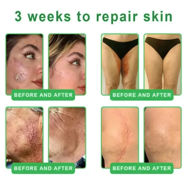 𝐎𝐫𝐢𝐚𝐜𝐡® 𝐀𝟏𝟎+ 𝟔-𝐢𝐧-𝟏 𝐃𝐞𝐫𝐦𝐚𝐑𝐞𝐩𝐚𝐢𝐫 𝐒𝐞𝐫𝐮𝐦 𝐅𝐃𝐀 𝐂𝐞𝐫𝐭𝐢𝐟𝐢𝐞𝐝 – 𝐅𝐢𝐫𝐦𝐬 𝐥𝐨𝐨𝐬𝐞 𝐬𝐤𝐢𝐧, 𝐟𝐚𝐝𝐞𝐬 𝐛𝐫𝐮𝐢𝐬𝐢𝐧𝐠 𝐚𝐧𝐝 𝐬𝐞𝐧𝐢𝐥𝐞 𝐩𝐮𝐫𝐩𝐮𝐫𝐚, 𝐚𝐧𝐝 𝐢𝐦𝐩𝐫𝐨𝐯𝐞𝐬 𝐤𝐞𝐫𝐚𝐭𝐢𝐧 𝐛𝐮𝐢𝐥𝐝𝐮𝐩, 𝐬𝐞𝐛𝐨𝐫𝐫𝐡𝐞𝐢𝐜 𝐝𝐞𝐫𝐦𝐚𝐭𝐢𝐭𝐢𝐬, 𝐚𝐧𝐝 𝐟𝐨𝐥𝐥𝐢𝐜𝐮𝐥𝐚𝐫 𝐤𝐞𝐫𝐚𝐭𝐨𝐬𝐢𝐬.