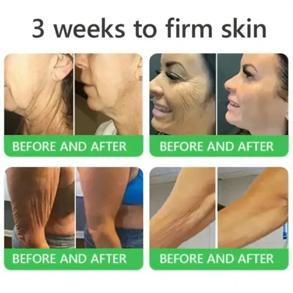 𝐎𝐫𝐢𝐚𝐜𝐡® 𝐀𝟏𝟎+ 𝟔-𝐢𝐧-𝟏 𝐃𝐞𝐫𝐦𝐚𝐑𝐞𝐩𝐚𝐢𝐫 𝐒𝐞𝐫𝐮𝐦 𝐅𝐃𝐀 𝐂𝐞𝐫𝐭𝐢𝐟𝐢𝐞𝐝 – 𝐅𝐢𝐫𝐦𝐬 𝐥𝐨𝐨𝐬𝐞 𝐬𝐤𝐢𝐧, 𝐟𝐚𝐝𝐞𝐬 𝐛𝐫𝐮𝐢𝐬𝐢𝐧𝐠 𝐚𝐧𝐝 𝐬𝐞𝐧𝐢𝐥𝐞 𝐩𝐮𝐫𝐩𝐮𝐫𝐚, 𝐚𝐧𝐝 𝐢𝐦𝐩𝐫𝐨𝐯𝐞𝐬 𝐤𝐞𝐫𝐚𝐭𝐢𝐧 𝐛𝐮𝐢𝐥𝐝𝐮𝐩, 𝐬𝐞𝐛𝐨𝐫𝐫𝐡𝐞𝐢𝐜 𝐝𝐞𝐫𝐦𝐚𝐭𝐢𝐭𝐢𝐬, 𝐚𝐧𝐝 𝐟𝐨𝐥𝐥𝐢𝐜𝐮𝐥𝐚𝐫 𝐤𝐞𝐫𝐚𝐭𝐨𝐬𝐢𝐬.