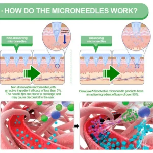 𝑪𝒍𝒆𝒓𝒂𝑳𝒖𝒙𝒆® 𝑩𝒆𝒓𝑏𝘦𝘳𝑖𝗇𝒆 𝟔-𝗶𝙣-𝟏 𝑁𝑎𝑛𝑜 𝘔𝘪𝘤𝘳𝘰𝘯𝘦𝘦𝘥𝘭𝘦 𝖯𝚊𝗍𝖼𝗁