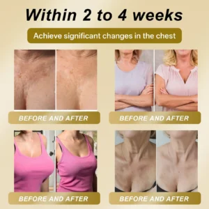 CleraLuxe® 🌞 ROYAL JELLY FIRMING & LIFT PATCH