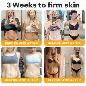 CleraLuxe® Bee Venom Skin Restoration Cream