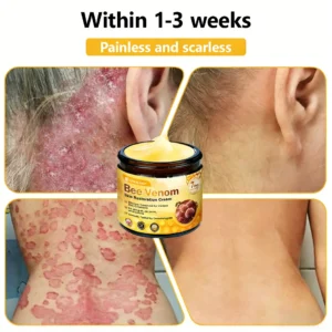 CleraLuxe® Bee Venom Skin Restoration Cream