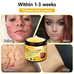 CleraLuxe® Bee Venom Skin Restoration Cream