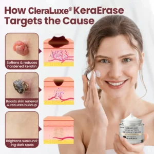 CleraLuxe® KeraErase Dual-Action Renewal Cream