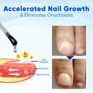 CleraLuxe® NailRebuild Nail Growth and Repair Serum+
