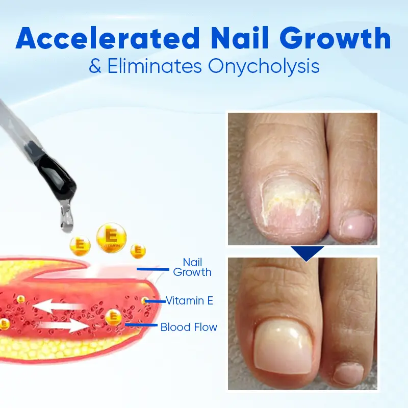 CleraLuxe® NailRebuild Nail Growth and Repair Serum+