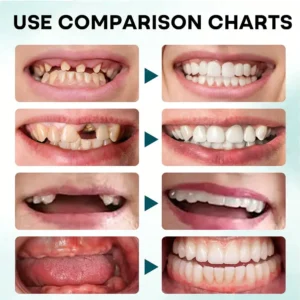 NESLEMY® FirmHold Denture Adhesive