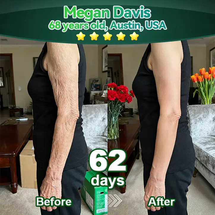 ๐ฃ๐๐ฟ๐ฒ๐น๐ผ๐ฟ๐ฎยฎ ๐ฆ๐๐ฒ๐บ ๐๐ฒ๐น๐นโ๐๐ฐ๐๐ถ๐๐ฎ๐๐ฒ๐ฑ ๐๐ผ๐น๐น๐ฎ๐ด๐ฒ๐ป ๐ฃ๐ฒ๐ฝ๐๐ถ๐ฑ๐ฒ ๐ฑ๐ฟ๐ผ๐ฝ๐