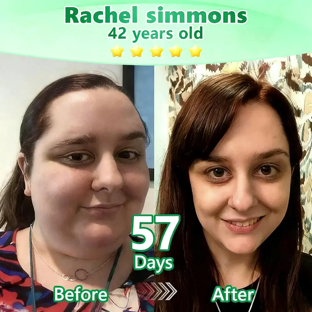 𝙋𝙪𝙧𝙚𝙡𝙪𝙭𝙤® Caffeine · L-Carnitine × Retinol | Slimming & Firming 2-in-1 Nano Microneedle Patch