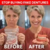 Custom-Fit Full Functional Dentures