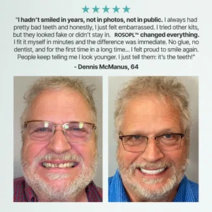 Custom-Fit Full Functional Dentures