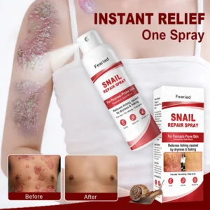Feariad Snail Repair Spray for Itchy, Flaky Psoriasis Skin