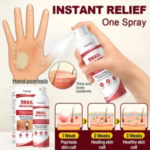 Feariad Snail Repair Spray for Itchy, Flaky Psoriasis Skin