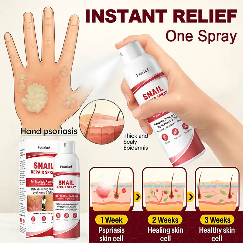 Feariad Snail Repair Spray for Itchy, Flaky Psoriasis Skin