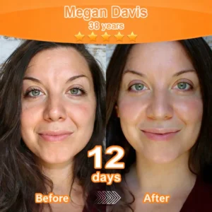 Purelora® Stem Cell–Derived EGF & Copper Peptide Revitalising Essence Cream