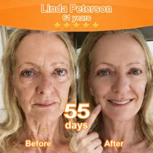 Purelora® Stem Cell–Derived EGF & Copper Peptide Revitalising Essence Cream