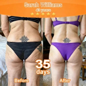 Purelora® Stem Cell–Derived EGF & Copper Peptide Revitalising Essence Cream