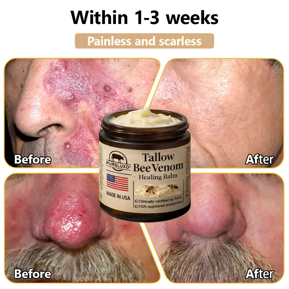 Pureluxo® Tallow Bee Venom Healing Balm