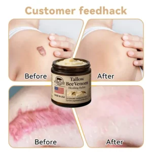 Pureluxo® Tallow Bee Venom Healing Balm