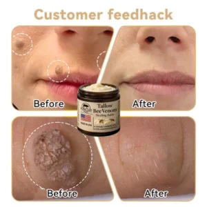 Pureluxo® Tallow Bee Venom Healing Balm