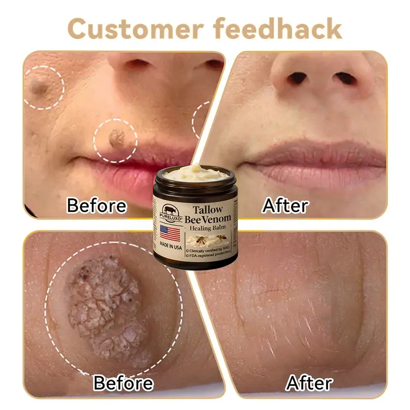 Pureluxo® Tallow Bee Venom Healing Balm