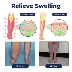 Timilk® SwellRelief Circulation Support Cream