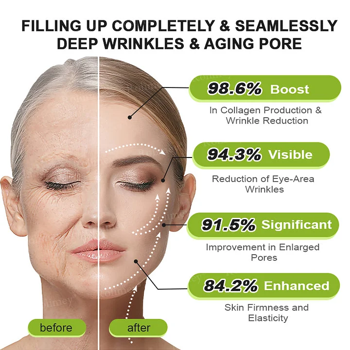 Rolimey® Botox & Vita-A Retinol Firming & Anti-Wrinkle Serum