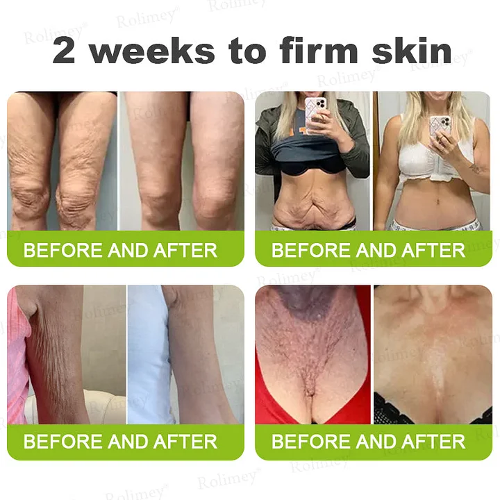 Rolimey® Botox & Vita-A Retinol Firming & Anti-Wrinkle Serum