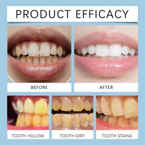 Feimuko Tooth Defense Serum with Nano Hydroxyapatite for Teeth Whitening and Deep Cleaning