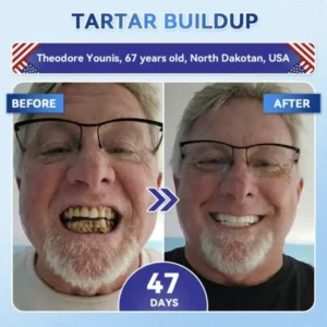 Your Smile~ SmileFitPro® 🦷 Tideglusib Fast‑Dissolving Tooth & Gum Repair Oral Strips ✨ (𝟓-𝐢𝐧-𝟏 💎 𝐑𝐞𝐛𝐮𝐢𝐥𝐝 𝐄𝐧𝐚𝐦𝐞𝐥 & 𝐃𝐞𝐧𝐭𝐢𝐧 • 𝐒𝐭𝐫𝐞𝐧𝐠𝐭𝐡𝐞𝐧 𝐆𝐮𝐦𝐬 • 𝐄𝐫𝐚𝐝𝐢𝐜𝐚𝐭𝐞 𝐓𝐚𝐫𝐭𝐚𝐫 & 𝐎𝐝𝐨𝐫 • 𝐖𝐡𝐢𝐭𝐞𝐧𝐢𝐧𝐠 • 𝐒𝐭𝐨𝐩 𝐓𝐨𝐨𝐭𝐡 𝐒𝐞𝐧𝐬𝐢𝐭𝐢𝐯𝐢𝐭𝐲)