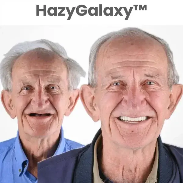 🎁🦷 HazyGalaxy™ Custom-Fit Smile Support Set ⏰ ENDS TODAY 49% OFF | Smile with Confidence😉