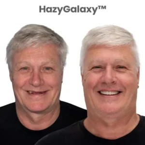 🎁🦷 HazyGalaxy™ Custom-Fit Smile Support Set ⏰ ENDS TODAY 49% OFF | Smile with Confidence😉