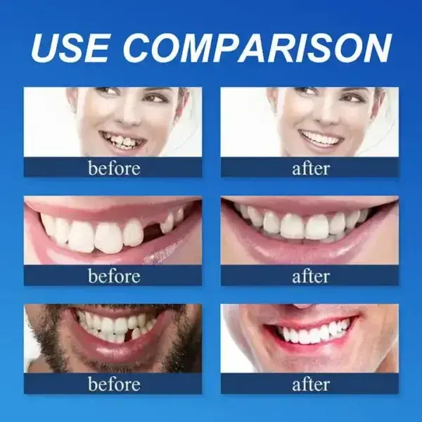 DarkFairy Custom-Fit Suction Dentures