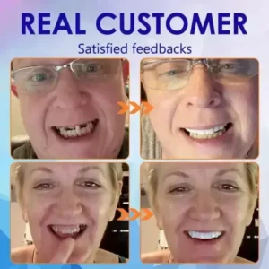 Vaxflite™ Advanced Full Denture Set